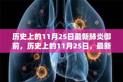 历史上的11月25日,最新肺炎御前产品全面评测与回顾